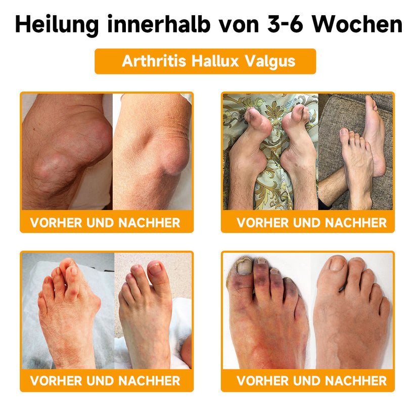 Bienengift Creme mit Hyaluron & Kollagen - Anti-Aging Gesichtscreme