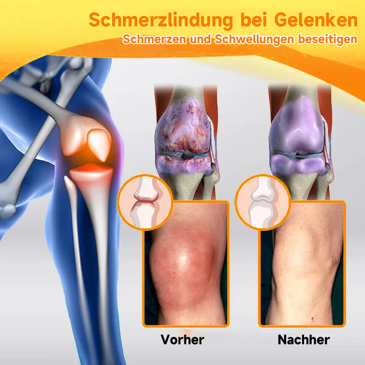 Bienengift Creme mit Hyaluron & Kollagen - Anti-Aging Gesichtscreme