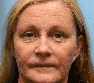 Anti-Aging Gesichtscreme mit Hyaluronsäure und Kollagen 50ml