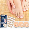 Nagelkorrektur Pads für eingewachsene Zehennägel - 50 Stück