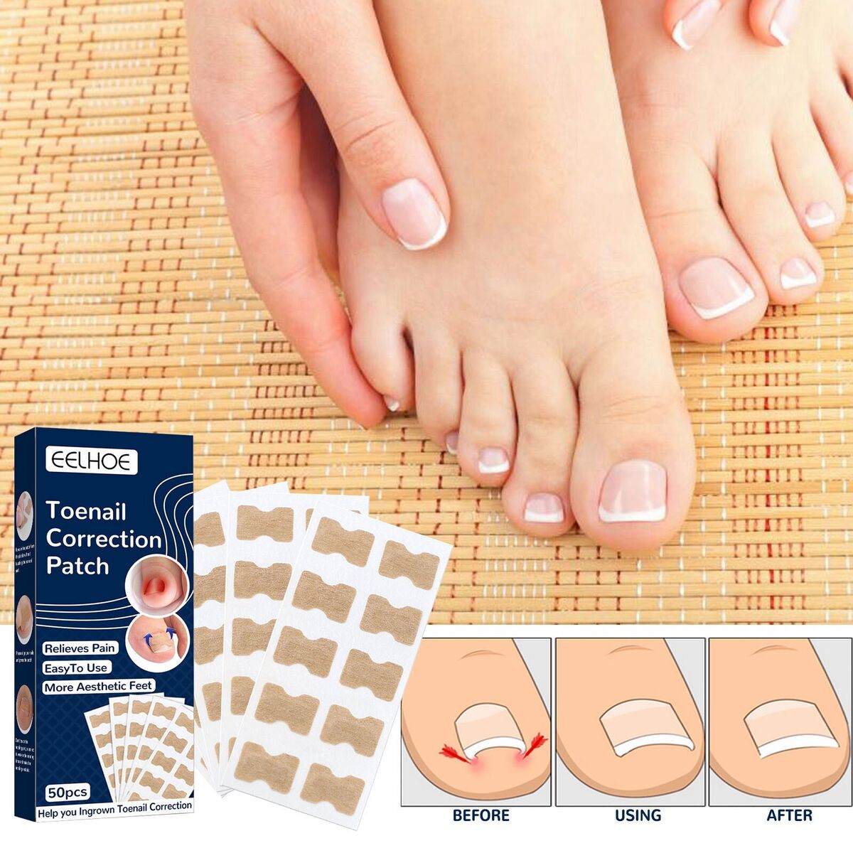 Nagelkorrektur Pads für eingewachsene Zehennägel - 50 Stück