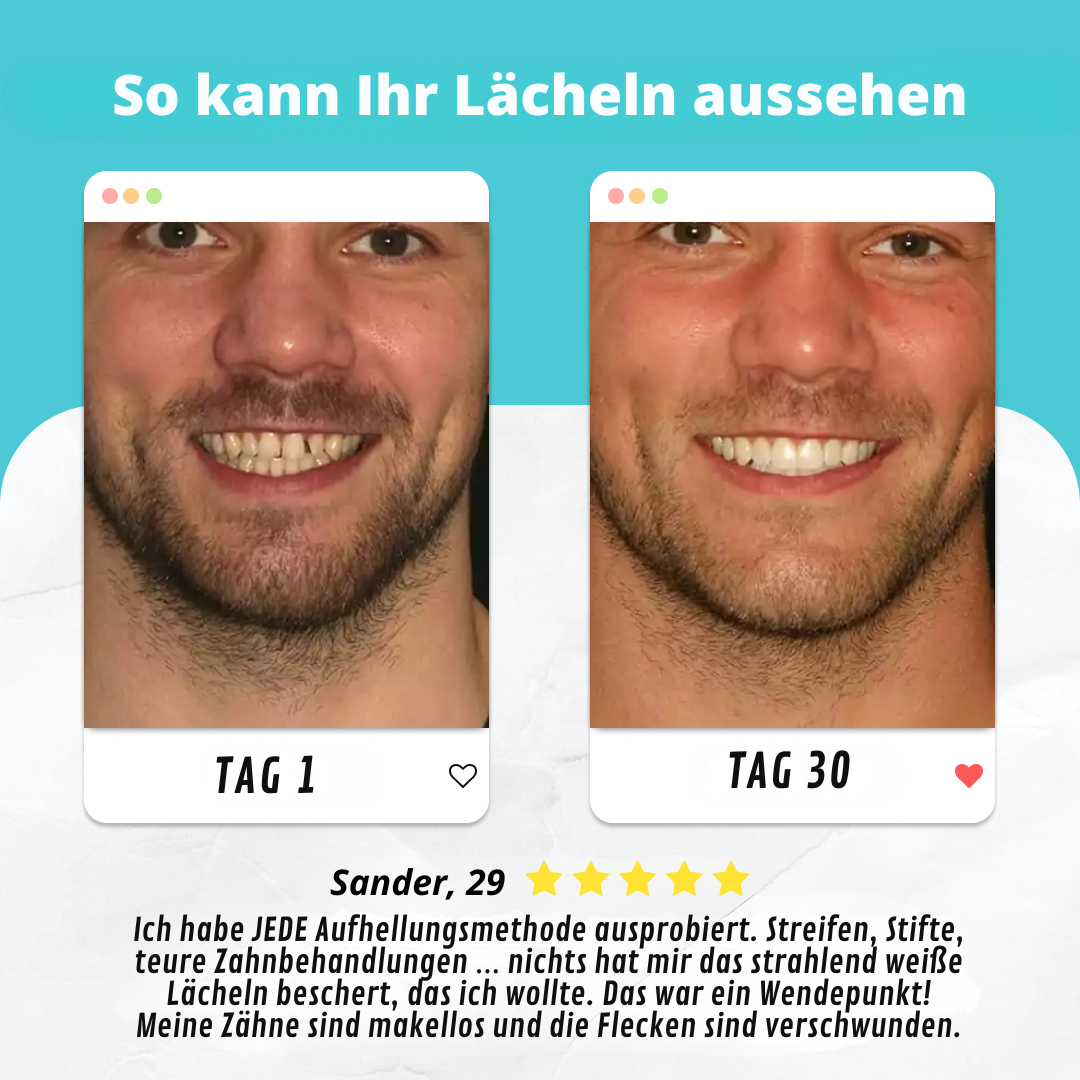 360° Silikon Zahnbürste mit UV-Licht - Automatisch & Wiederaufladbar